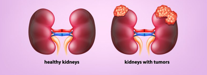 Best Medical oncologists in Vile Parle